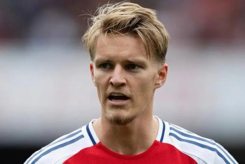 阿爾特塔：厄德高腳踝受傷“相當嚴重”